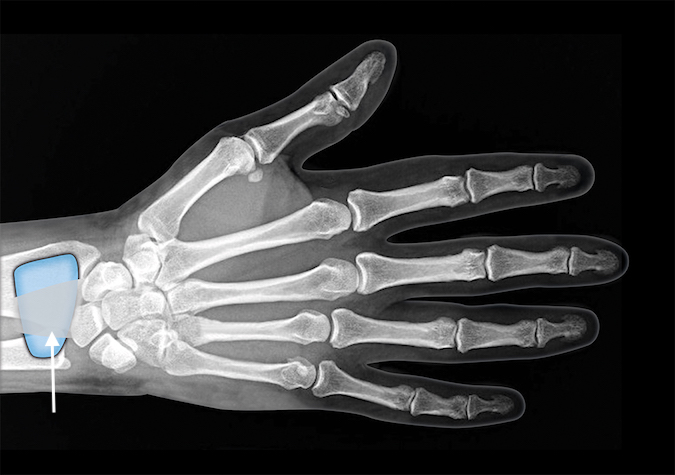 ANATOMY | Hand Surgery Resource