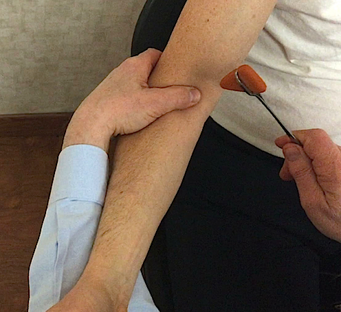 Biceps Reflex (C5) at right elbow.