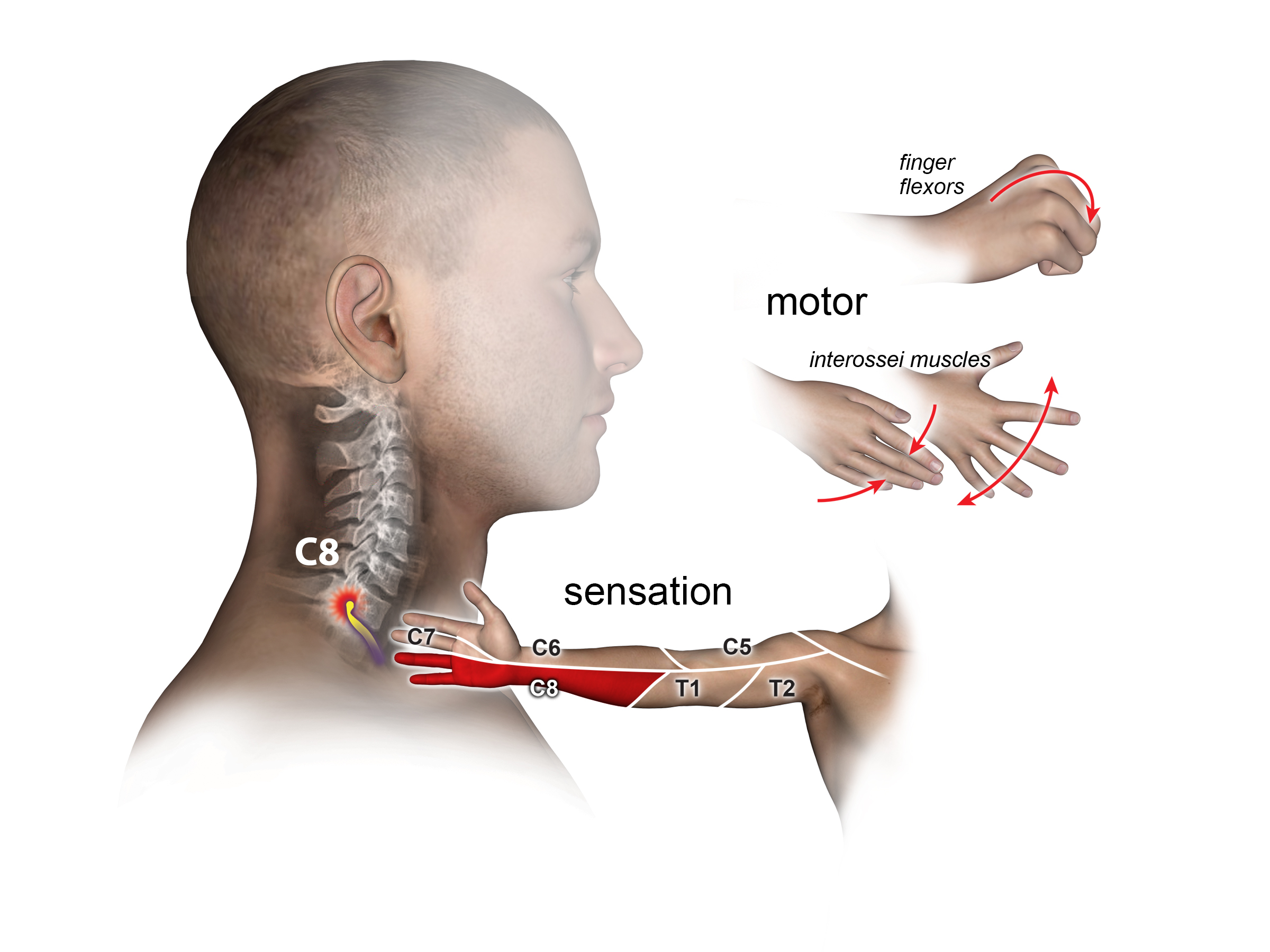 Motor and sensory exam for C8 Root