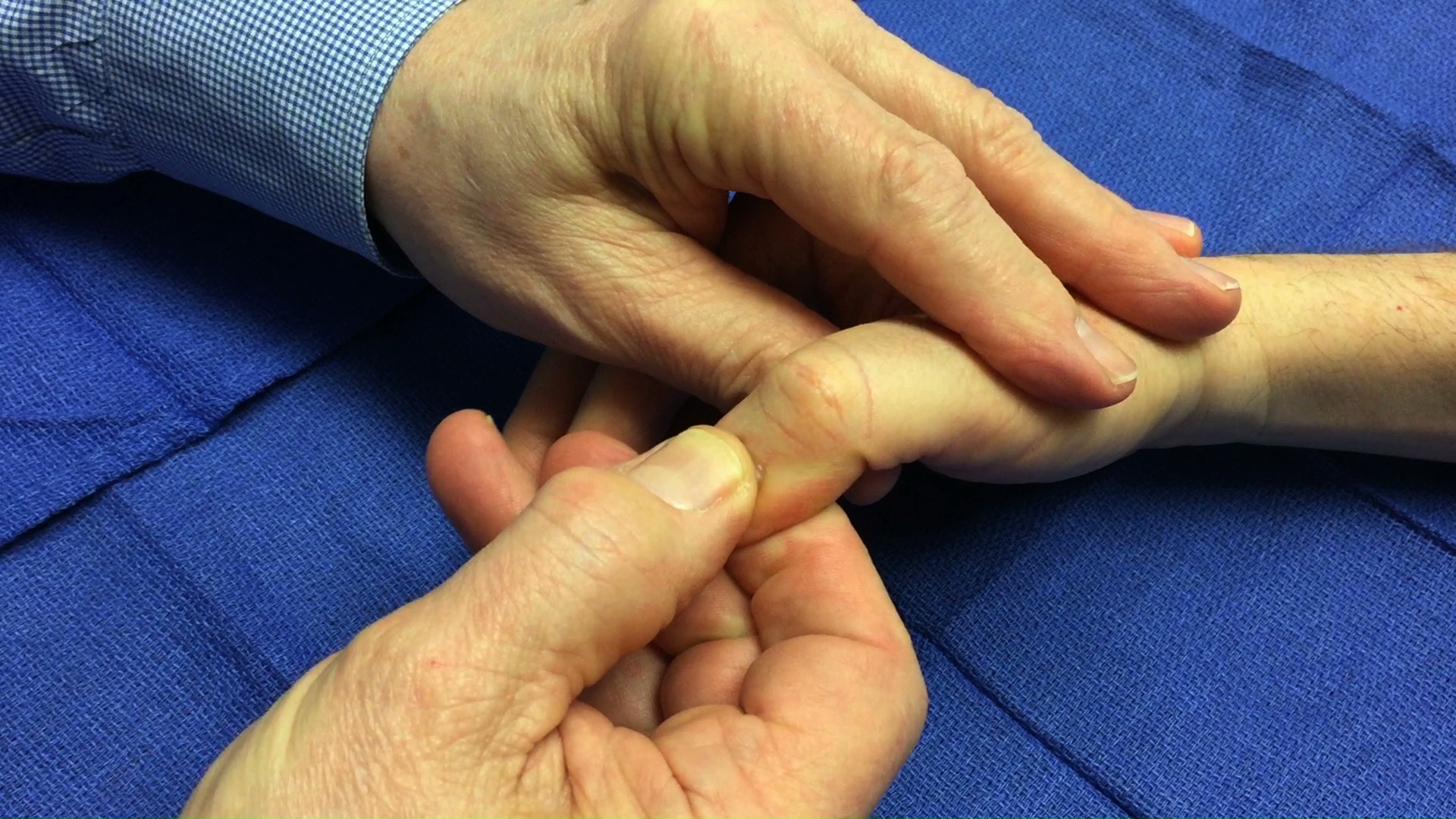 To Assess capillary refill first compress the nail bed