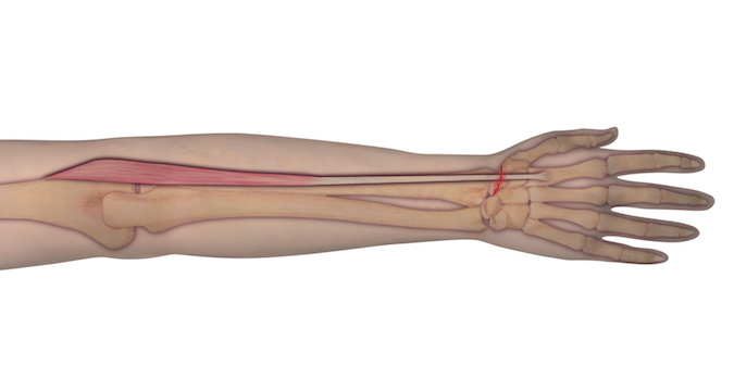 This illustration represents the anatomy of the muscle and tendon origin and insertion. Should an individual sustain a laceration as depicted, the observer can assume that the underlying tendon may be at risk for complete transection. A proper examination is needed to determine the integrity of the tendon.