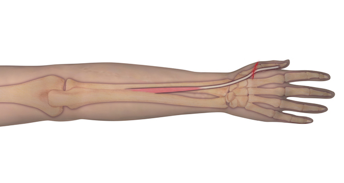 This illustration represents the anatomy of the muscle and tendon origin and insertion. Should an individual sustain a laceration as depicted, the observer can assume that the underlying tendon may be at risk for complete transection. A proper examination is needed to determine the integrity of the tendon.