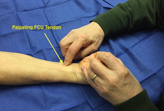 Muscle Test and Tendon Exam: Flexor Carpi Ulnaris (FCU) | Hand Surgery ...