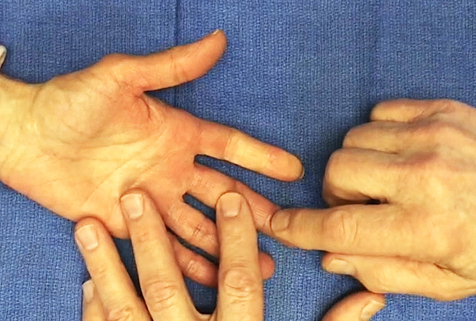 Flexor Digitorum Profundus III Tendon testing left hand