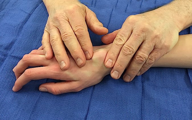 Palpation of Dorsal Wrist Mass