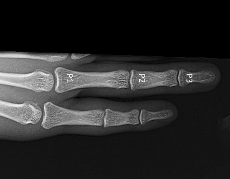 Radiology Studies - X-ray | Hand Surgery Resource