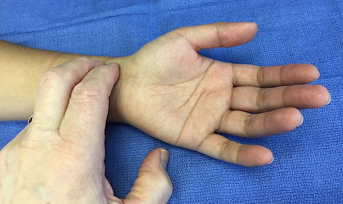 Palpating Radial Artery pulse at wrist.