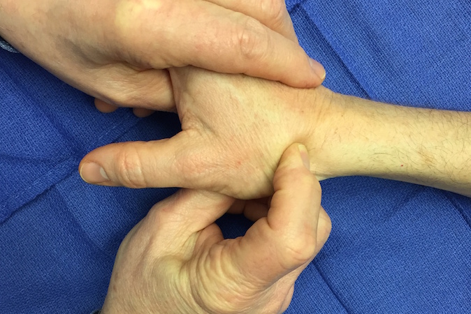 Palpation of scaphoid in anatomic snuff box.