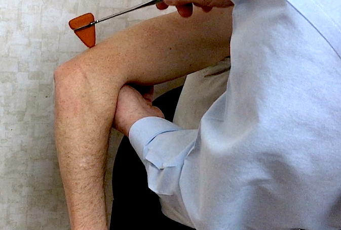 Triceps Reflex (C7) at right elbow.