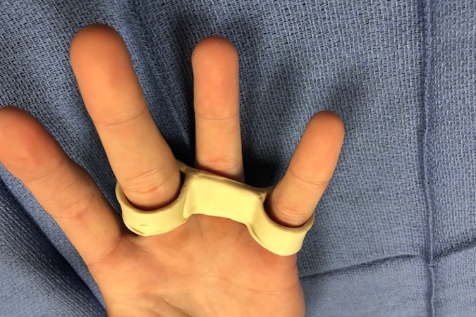 Yoke Splint palmar view